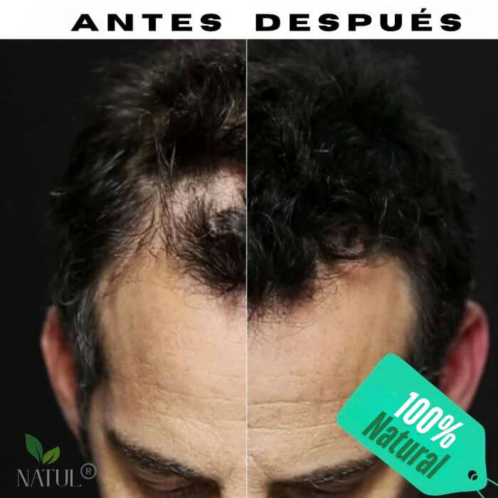Toppik™ Fibra Capilar Instantánea – Cabello más denso y natural en segundos