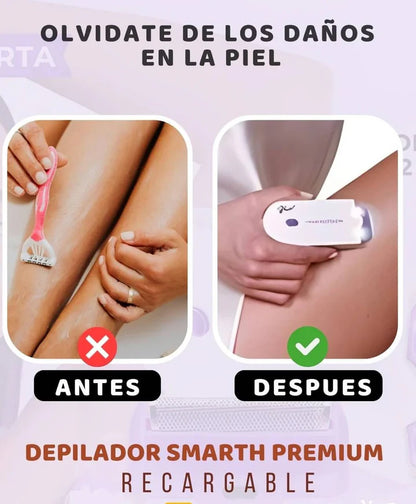 Depiladora Portátil Skin Yes ¡Despídete del vello no deseado!